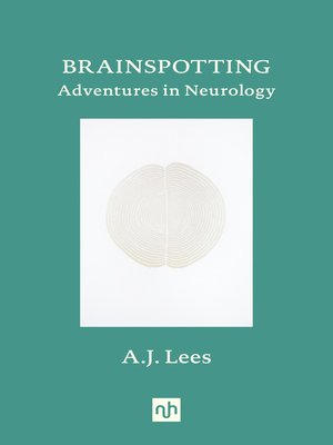 cover image of Brainspotting